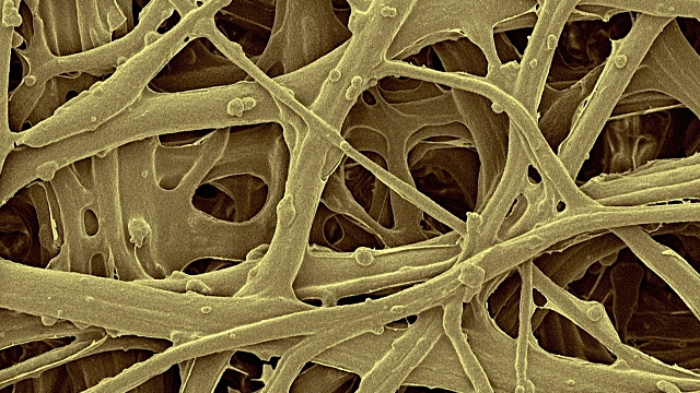 Animated coloured scanning electron micrograph (SEM) Chicken eggshell inner membrane (Gallus gallus domesticus). Shown here is the eggshell inner membrane that is composed of protein fibres (internal and attached to the hard eggshell). Several membranes are found around the embryo of a bird egg. The inner eggshell membrane adheres to the inner surface of the eggshell. As the chick develops changes in the eggshell allow the passage of carbon dioxide and oxygen and the release of water vapour by way of the eggshell membranes. Eggshells are the outer covering of hard-shelled eggs and of other eggs with soft outer coats. Eggshell structure varies widely among species. Birds and some reptiles produce hard-shelled eggs. Bird eggshells are composed of a protein matrix lined with mineral crystals, usually calcium carbonate (CaCO3). Most of the eggshell is composed of calcium carbonate crystals (approximately 95%).